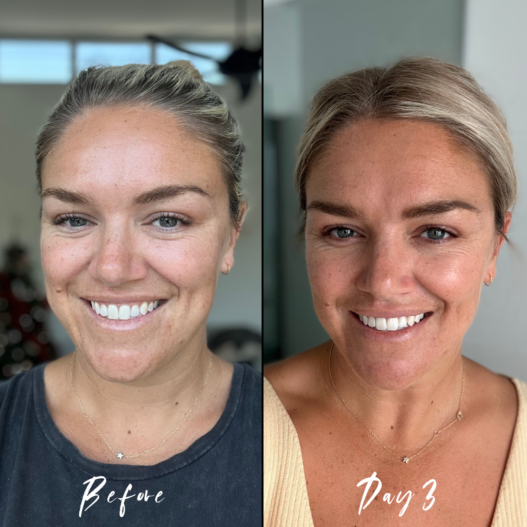 Before and After Botanique Facial Glaze - Mother of Tan